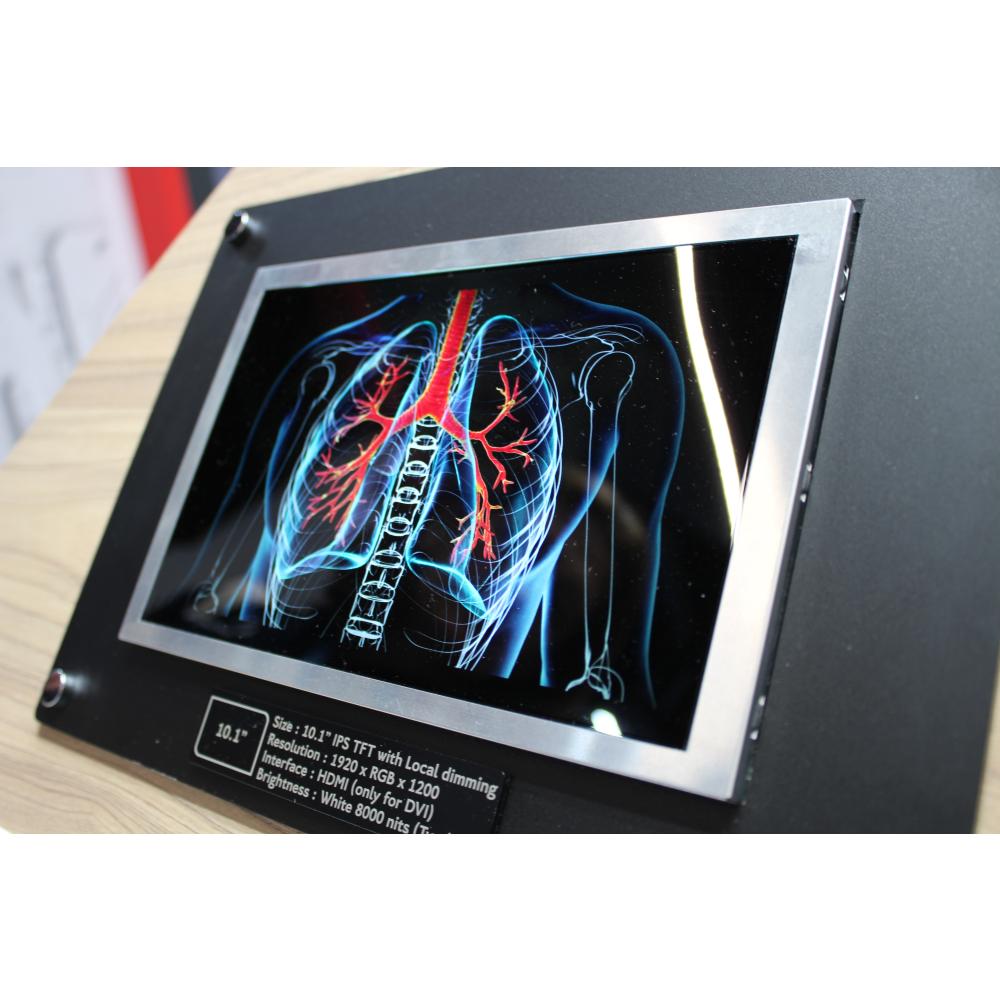 Anders Technology Roadshow