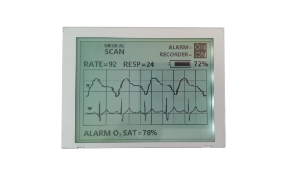 4.7" FSTN Monochrome LCD Display